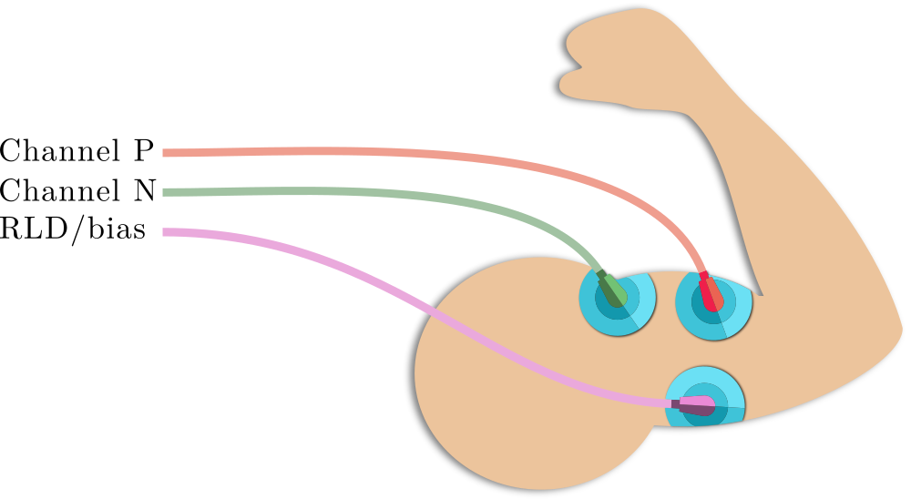 Diagram of the electrode placement for Electromyography.