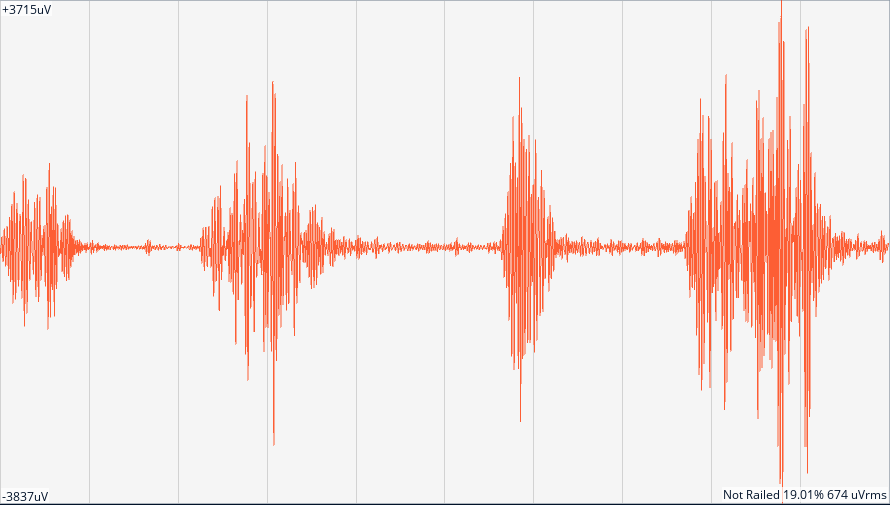 EMG plot recorded with the BioSgnals rev.2 PCB.